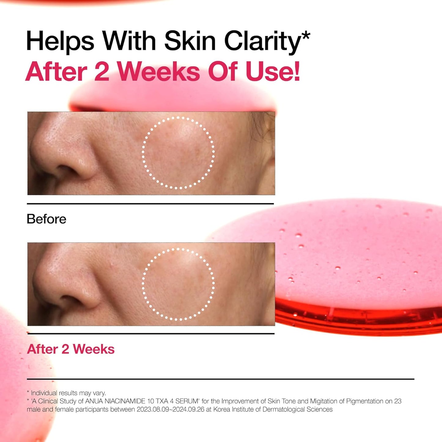 Anua - Niacinamide 10% + TXA 4% Serum 30 ML