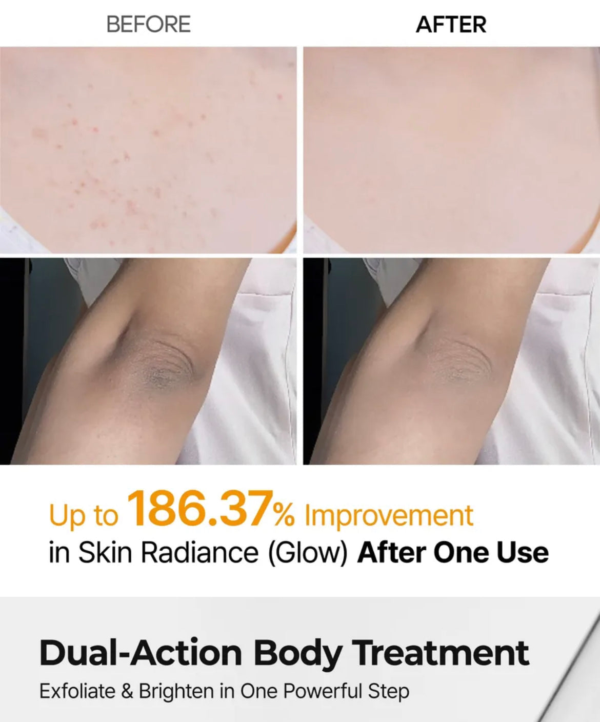 Dr.Melaxin Peel Shot Exfoliating Kojic Acid Turmeric Spray 200ml