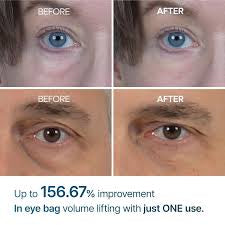 Dr.Melaxin Eyephalt Eyecream for Eyebags