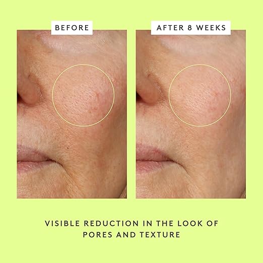 Drunk Elephant T.L.C. Framboos Glycolic Serum - Exfoliating AHA Serum - Clean Clinical Skincare