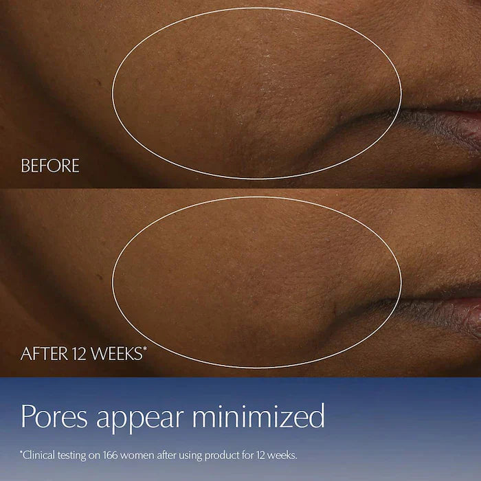 Estee Lauder Advanced Night Repair Synchronized Multi-Recovery Complex Serum with Hyaluronic Acid