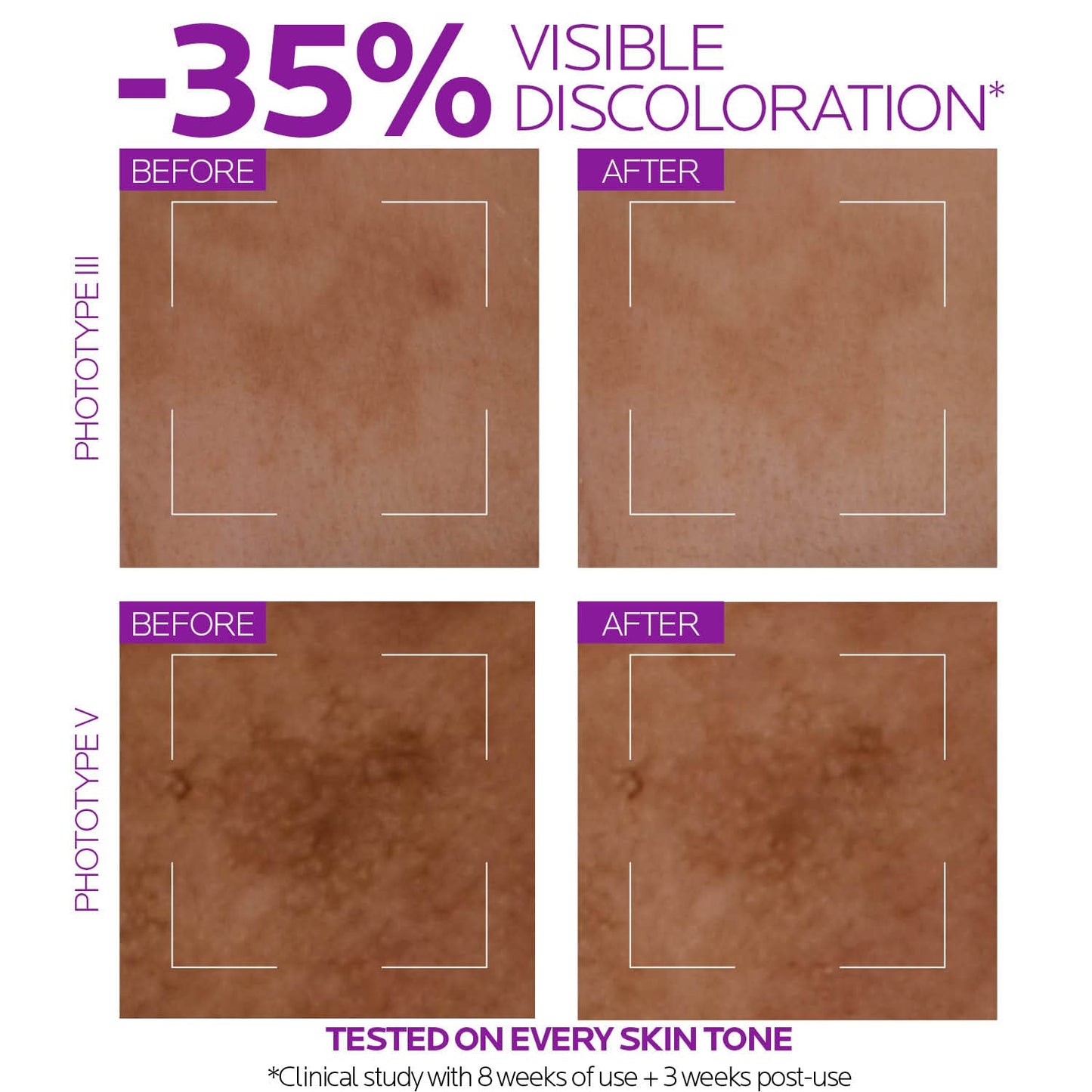 La roche posay Pure Niacinamide 10 30 ML