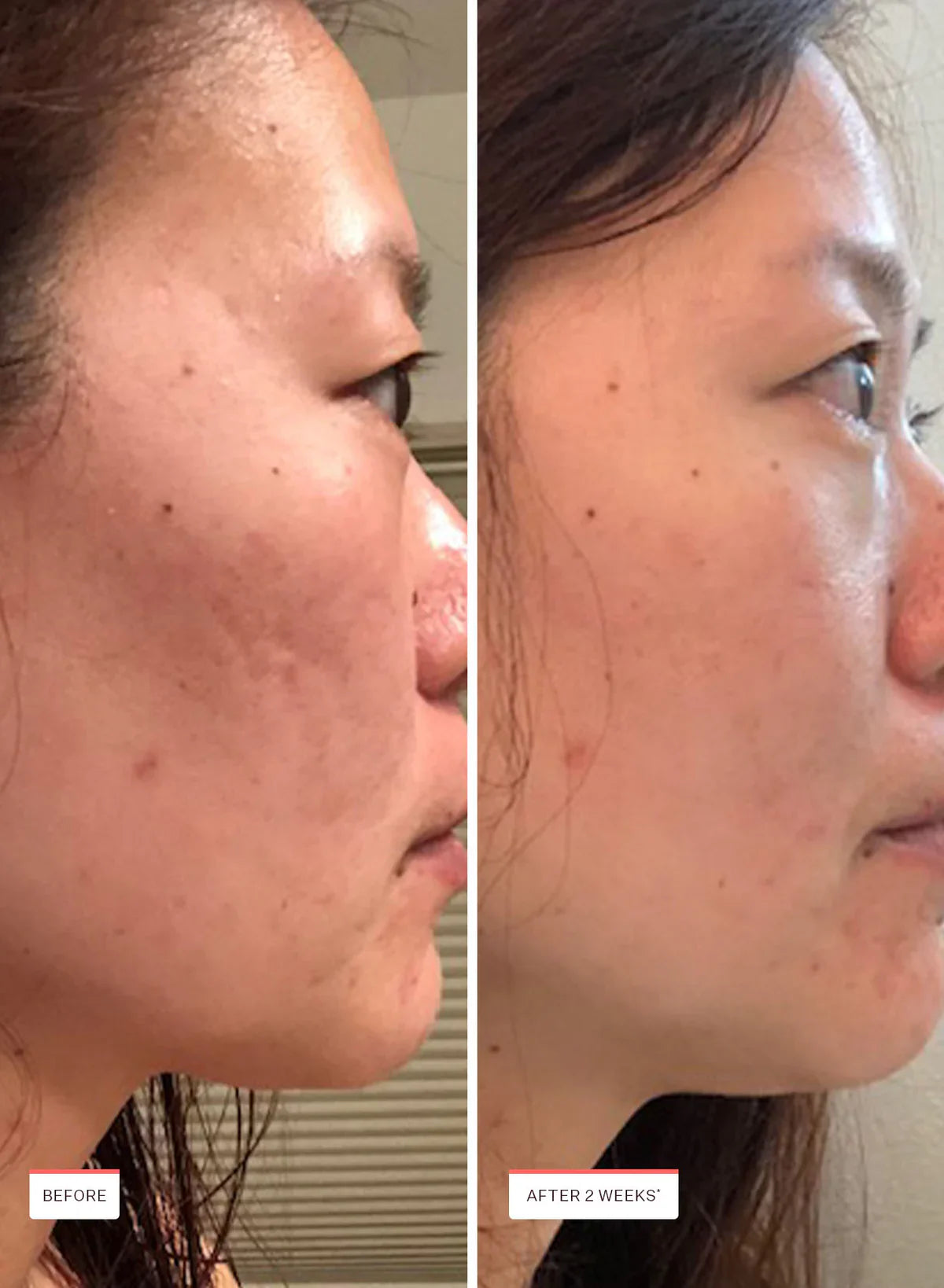 Peach And Lily Glass Skin Refining Serum