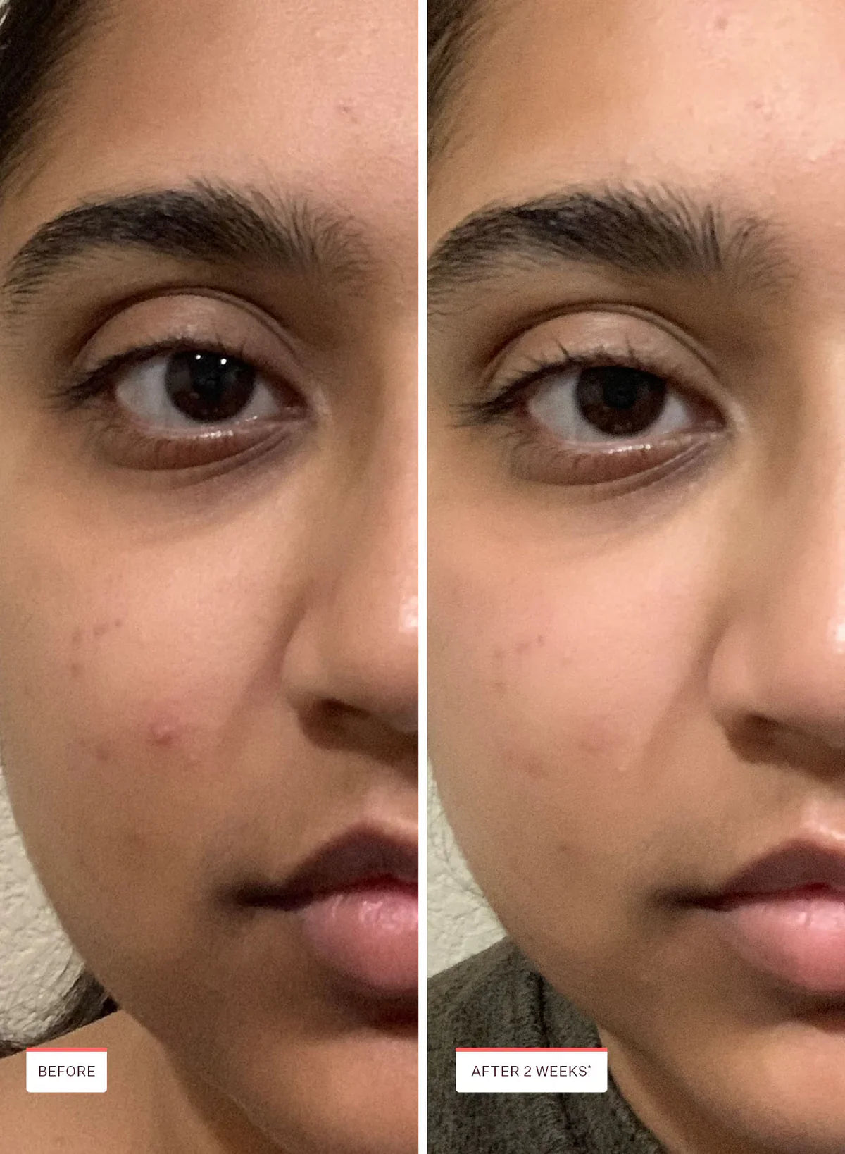 Peach And Lily Glass Skin Refining Serum