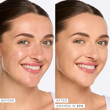 Tarte Face Concealers