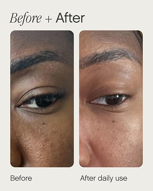 Topicals Sealed Active Scar Filling Primer for Acne Prone Skin 28ml